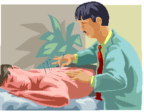 acupuncture